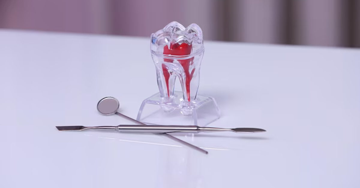 How Long Does A Root Canal Take